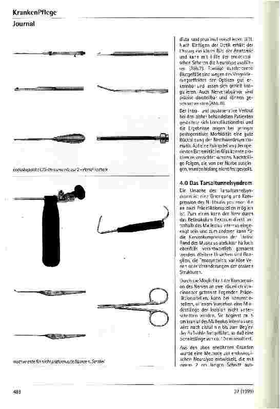 Vorschauseite 3: Endoskopische Methoden in der peripheren Nervenchirurgie