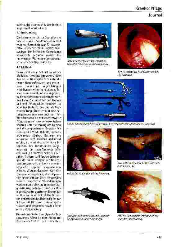 Vorschauseite 4: Endoskopische Methoden in der peripheren Nervenchirurgie