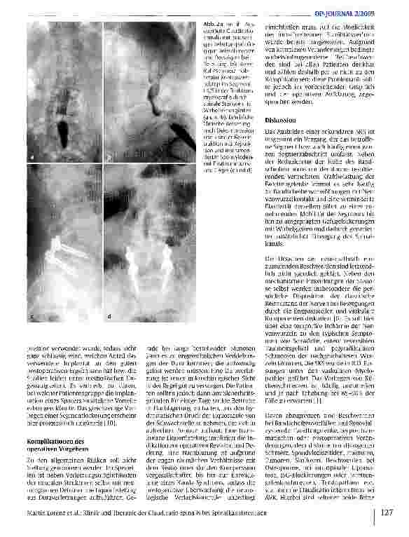 Vorschauseite 4: Klinik und Therapie der Claudicatio spinalis bei Spinalkanalstenosen