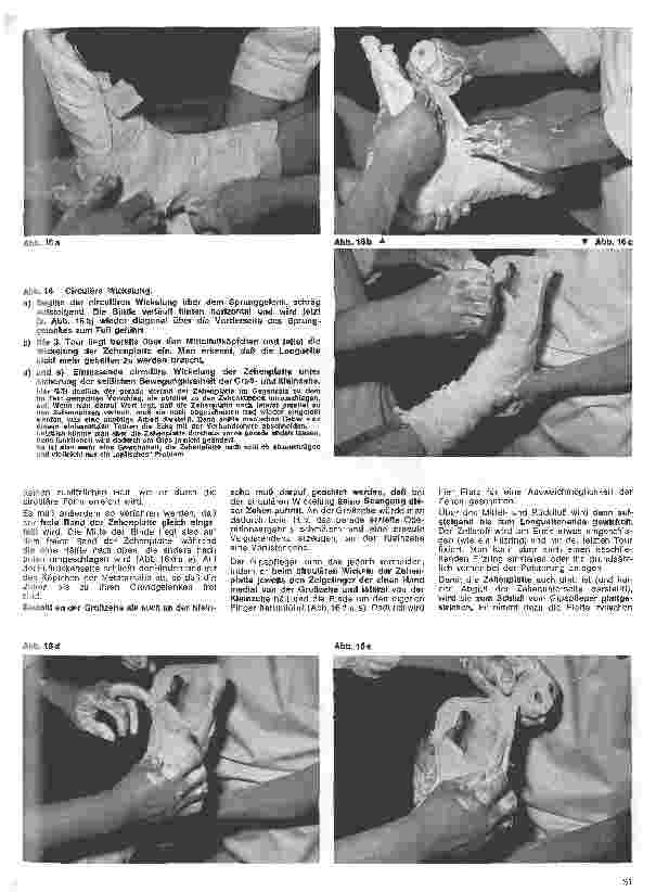 Vorschauseite 2: Grundlagen und Technik des Gipsverbandes 11. Folge: Fußgips nach OP eines Hallux valgus nach Brandes