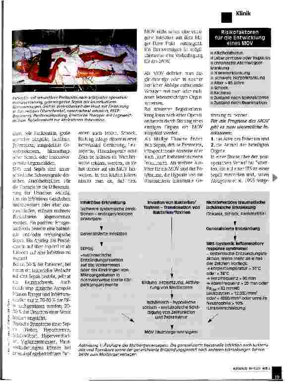 Vorschauseite 2: Die Gefahr der Sepsis Prophylaxe, Früherkennung, Therapie Peroperative Therapieprobleme 3. Teil