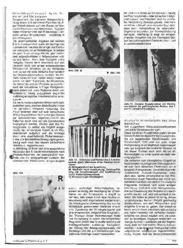 Vorschauseite 5: Die Wirbelsäulenverletzung des alten Menschen