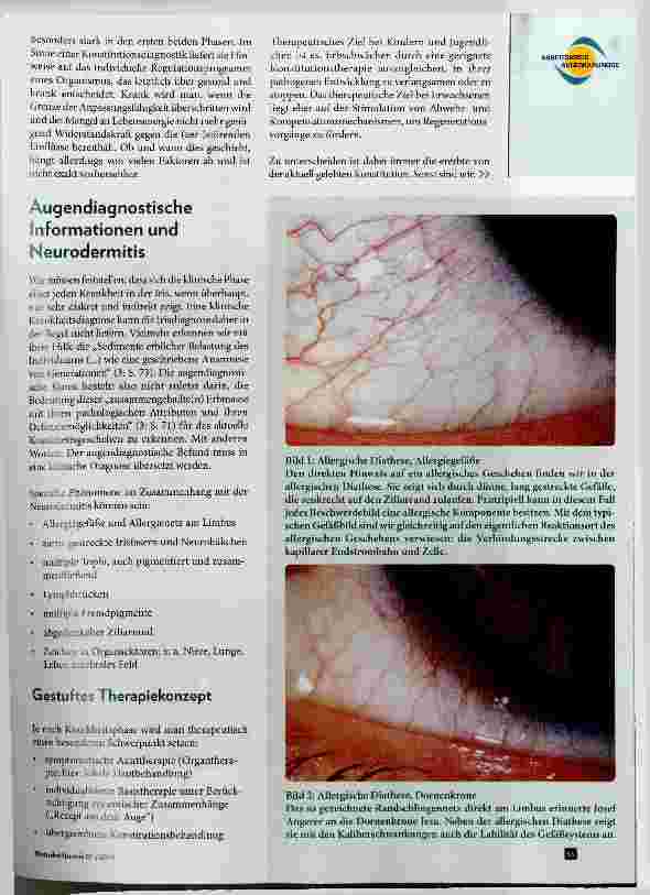 Vorschauseite 2: Augendiagnose und Neurodermitis wie geht das?
