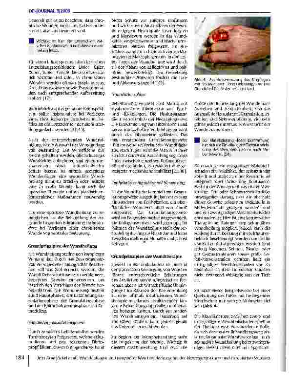 Vorschauseite 3: Wundauflagen und temporäre Weichteildeckung bei der Versorgung akuter und chronischer Wunden