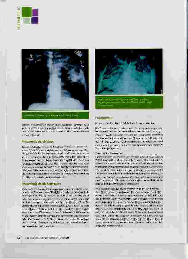 Vorschauseite 4: Pneumonie eine nicht zu unterschätzende Gefahr