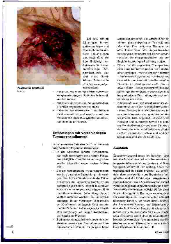Vorschauseite 3: Krebs in der Geriatrie