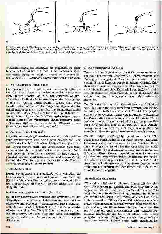 Vorschauseite 3: Hörverbessernde Operation