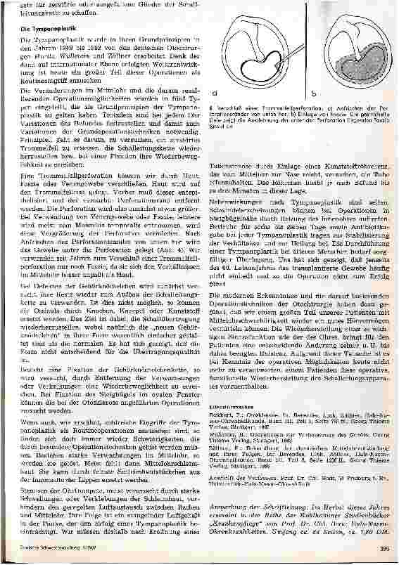 Vorschauseite 4: Hörverbessernde Operation