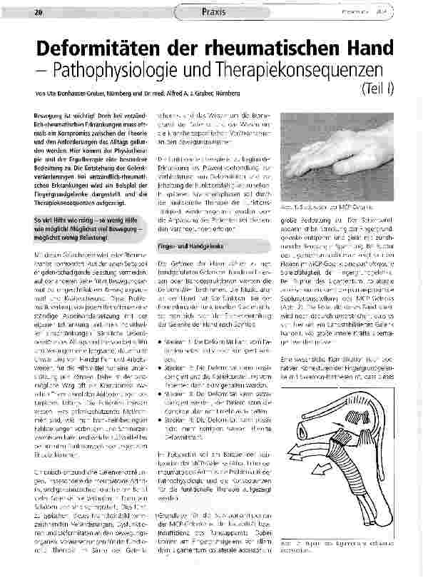 Vorschauseite 1: Deformitäten der rheumatischen HandPathophysiologie und Therapiekonsequenzen (Teil I)