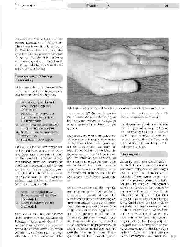 Vorschauseite 2: Deformitäten der rheumatischen HandPathophysiologie und Therapiekonsequenzen (Teil I)