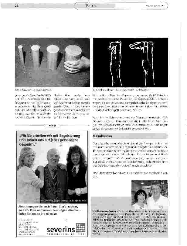 Vorschauseite 3: Deformitäten der rheumatischen HandPathophysiologie und Therapiekonsequenzen (Teil I)