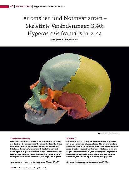 Vorschauseite 1: Anomalien und Normvarianten – Skelettale Veränderungen 3. 40: Hyperostosis frontalis interna