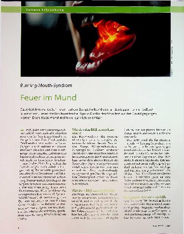 Vorschauseite 1: Feuer im Mund