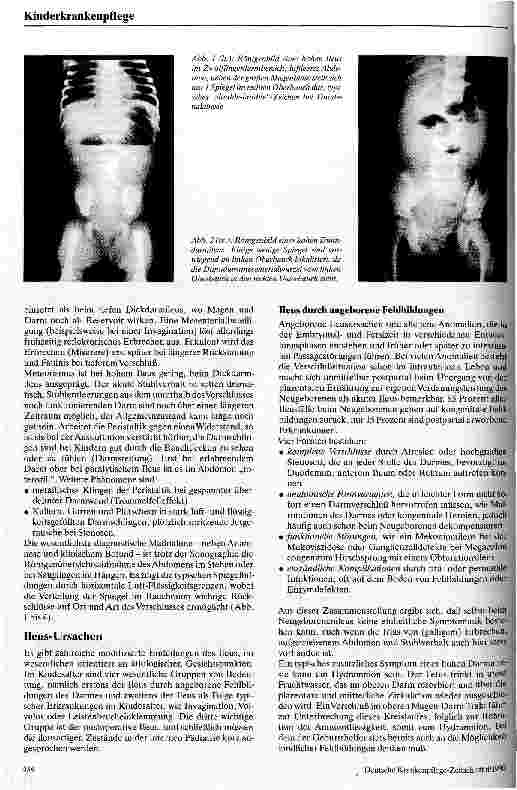 Vorschauseite 2: Ileus im Kindesalter