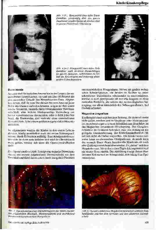 Vorschauseite 3: Ileus im Kindesalter