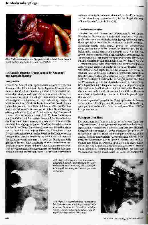 Vorschauseite 4: Ileus im Kindesalter