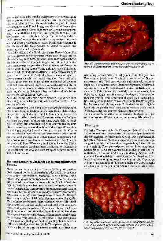 Vorschauseite 5: Ileus im Kindesalter