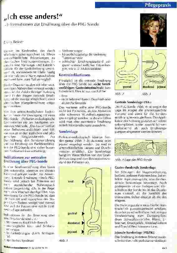 Vorschauseite 1: Ich esse anders! - Informationen zur Ernährung über die PEG-Sonde