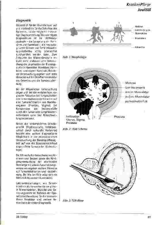 Vorschauseite 2: Harnblasenkrebs - Diagnose und Therapie