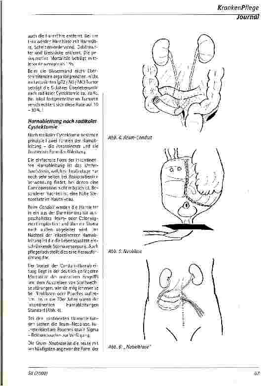 Vorschauseite 4: Harnblasenkrebs - Diagnose und Therapie