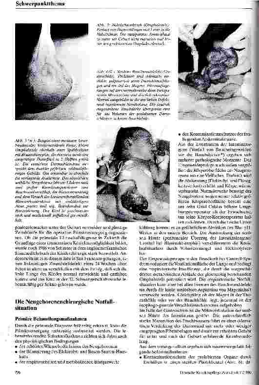 Vorschauseite 3: Angeborene Bauchwanddefekte