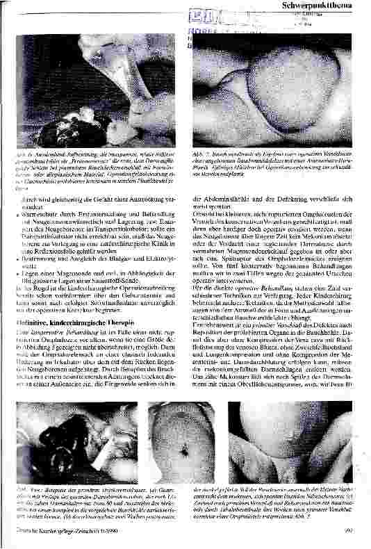 Vorschauseite 4: Angeborene Bauchwanddefekte
