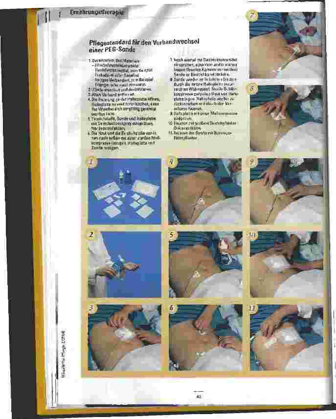 Vorschauseite 2: Ambulante enterale Ernährungstherapie Versorgung der Patienten durch ambulante Dienste