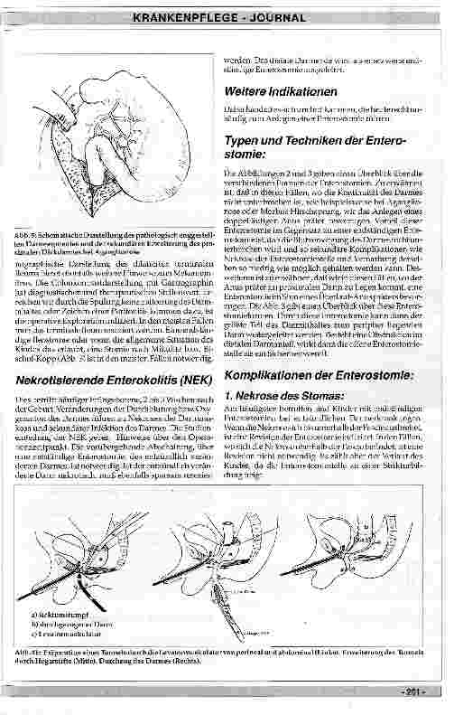 Vorschauseite 4: Stomachirurgie bei Kindern