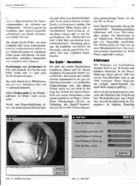 Vorschauseite 4: Das Projekt Qualis PC-unterstützte medizinische Dokumentation, Qualitätssicherung und Kommunikation