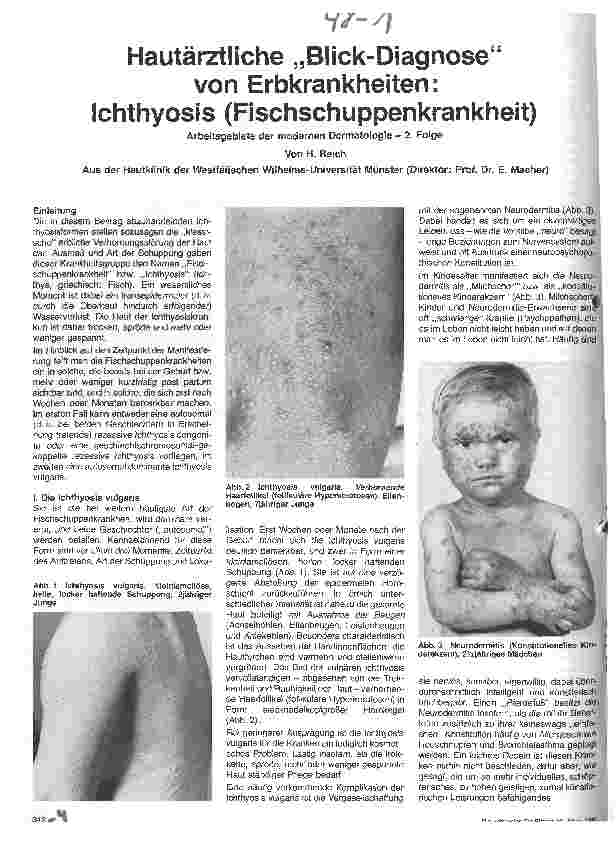Vorschauseite 1: Hautärztliche Blick-Diagnose von Erbkrankheiten: Ichthyosis (Fischschuppenkrankheit)