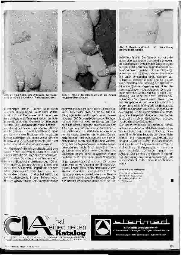 Vorschauseite 2: Physiologie und Pathologie des Nabels Kinderheilkunde