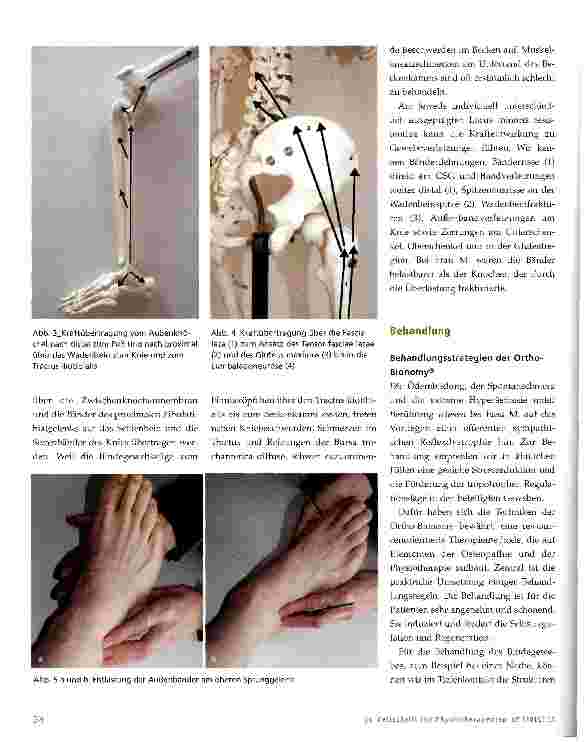 Vorschauseite 3: Supinationstrauma