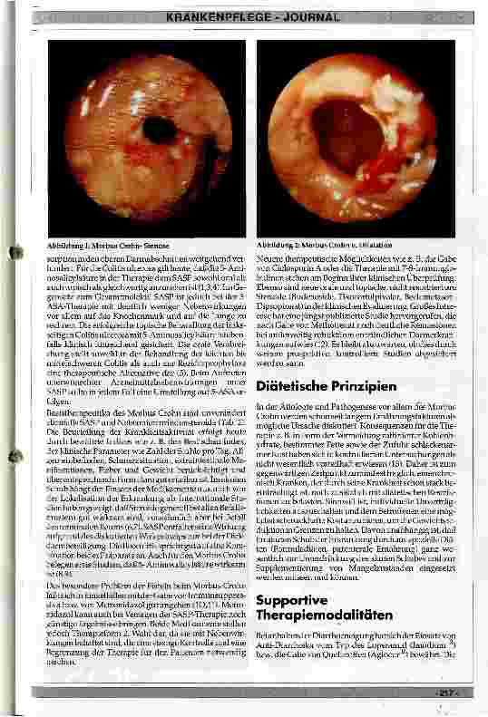 Vorschauseite 2: Therapie der entzündlichen Erkrankungen des Darmes aus internistischer Sicht
