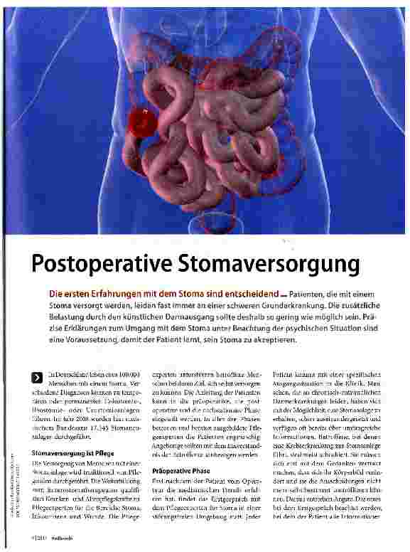 Vorschauseite 1: Postoperative Stomaversorgung
