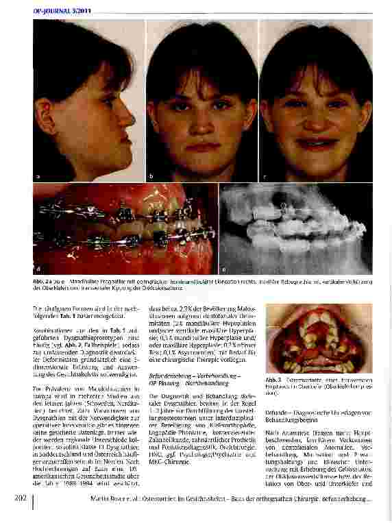 Vorschauseite 3: Osteotomien im Gesichtsskelett - Basis der orthognathen Chirurgie: Befunderhebung, präoperative Planung und individuelle Realisation bei Korrekturoperationen von Kieferund Gesicht…