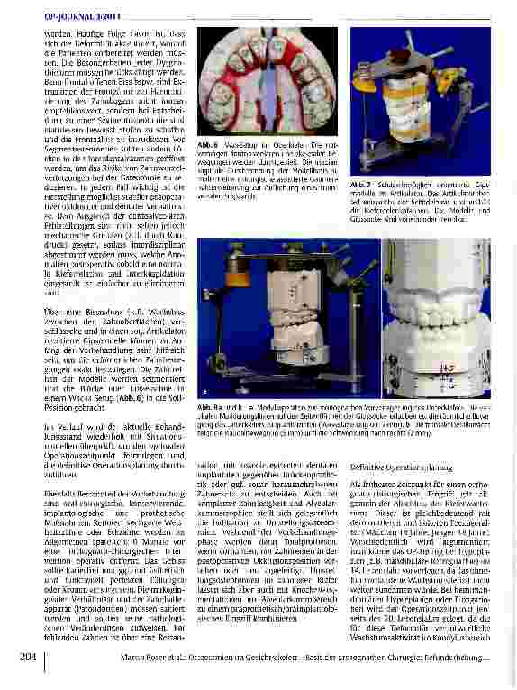 Vorschauseite 5: Osteotomien im Gesichtsskelett - Basis der orthognathen Chirurgie: Befunderhebung, präoperative Planung und individuelle Realisation bei Korrekturoperationen von Kieferund Gesicht…