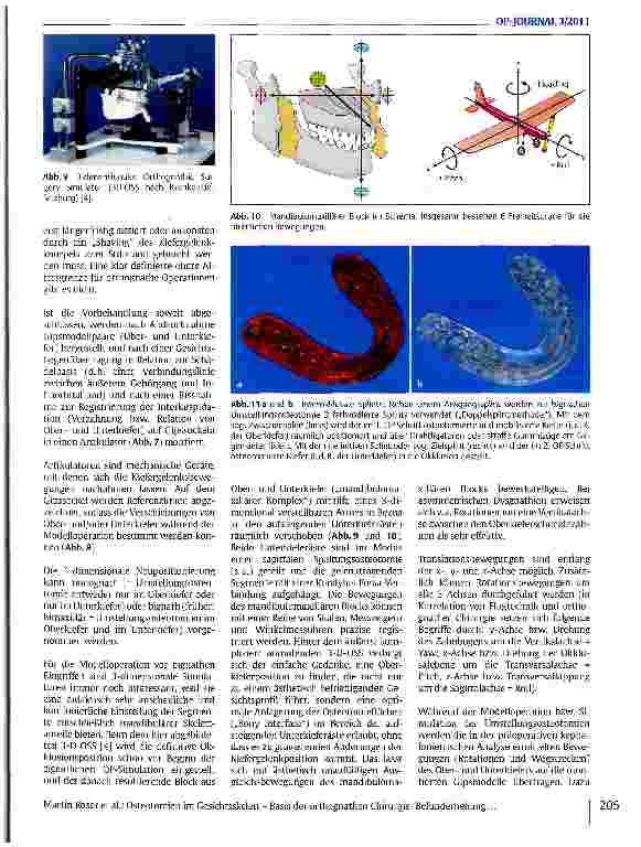 Vorschauseite 6: Osteotomien im Gesichtsskelett - Basis der orthognathen Chirurgie: Befunderhebung, präoperative Planung und individuelle Realisation bei Korrekturoperationen von Kieferund Gesicht…