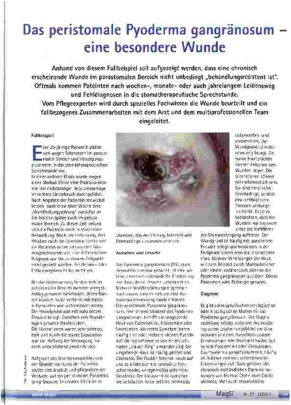 Vorschauseite 1: Das peristomale Pyoderma gangränosum eine besondere Wunde