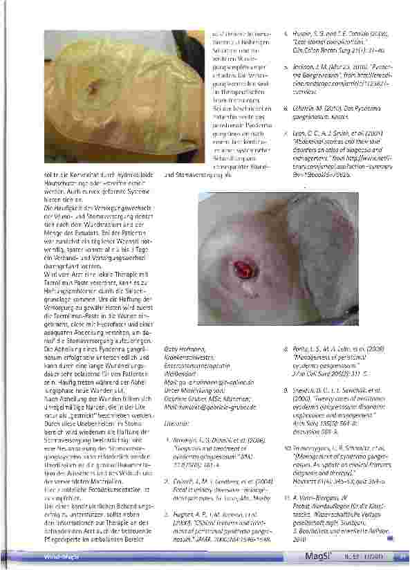 Vorschauseite 3: Das peristomale Pyoderma gangränosum eine besondere Wunde