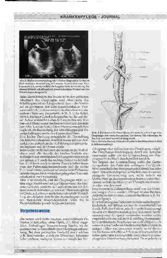 Vorschauseite 2: Transösophageale Echokardiographie - Grundlagen, diagnostische Aussagen, Indikationen