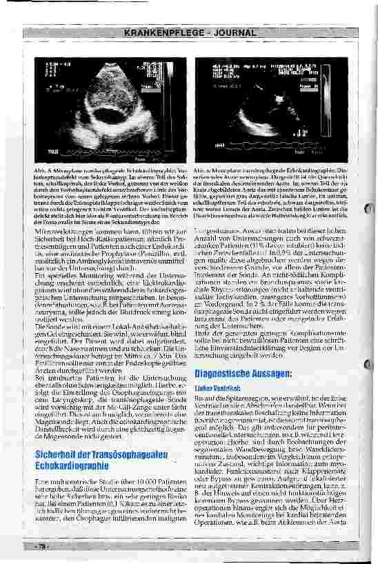 Vorschauseite 3: Transösophageale Echokardiographie - Grundlagen, diagnostische Aussagen, Indikationen