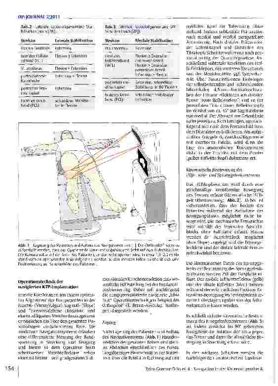 Vorschauseite 3: Navigation in der Knieendoprothetik