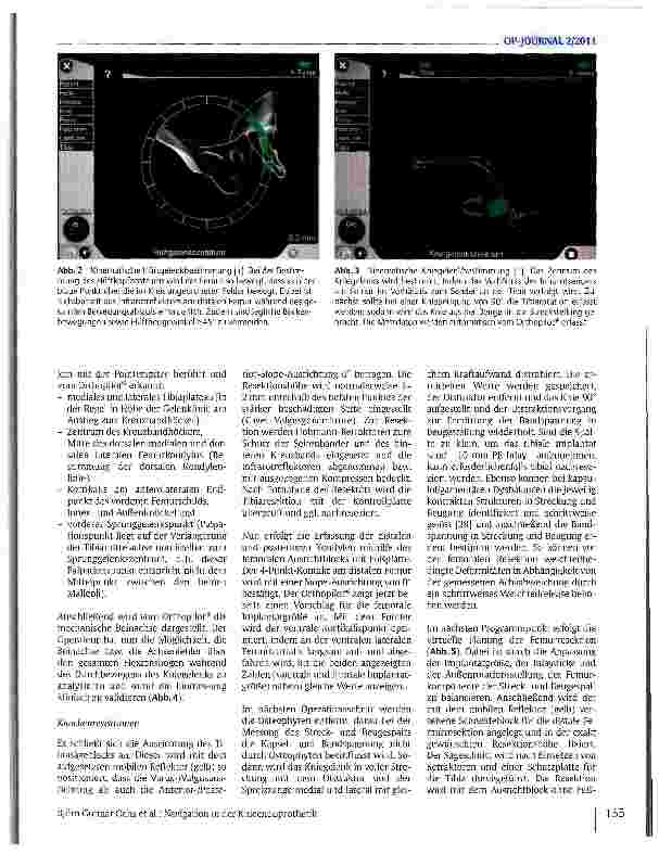 Vorschauseite 4: Navigation in der Knieendoprothetik