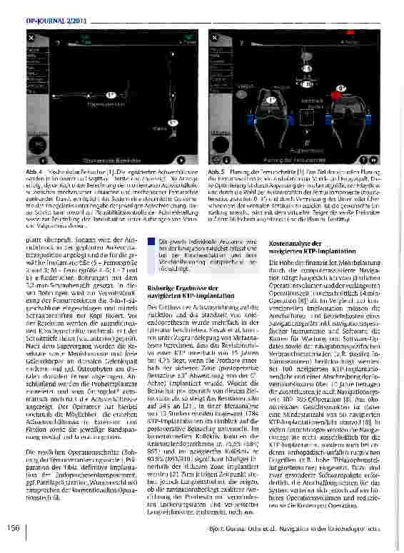 Vorschauseite 5: Navigation in der Knieendoprothetik