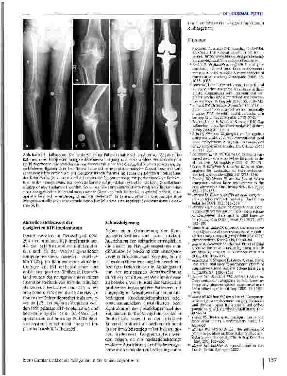 Vorschauseite 6: Navigation in der Knieendoprothetik