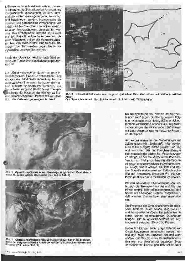 Vorschauseite 2: Ovarialkarzinom