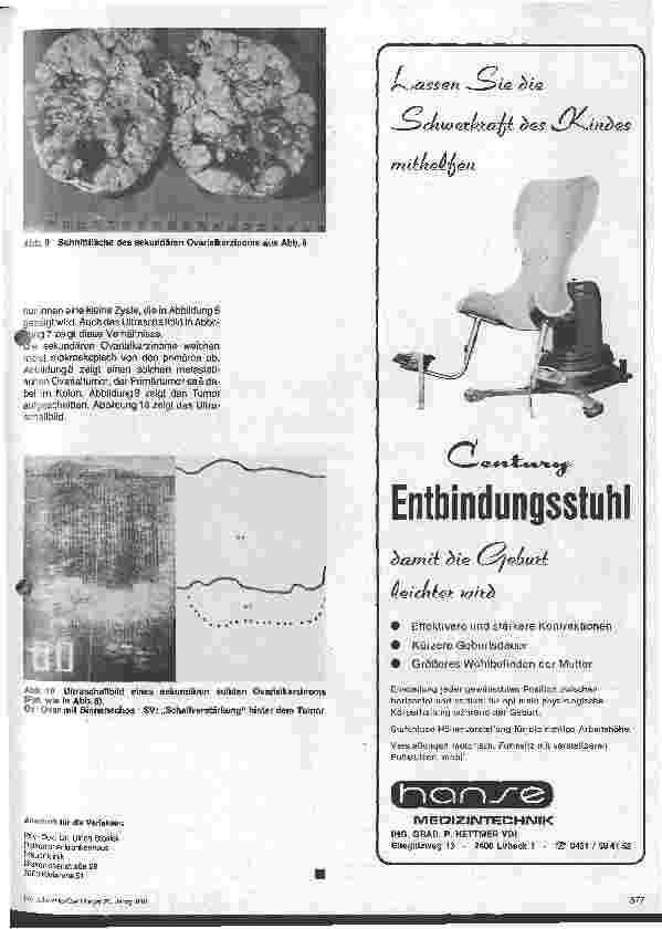 Vorschauseite 4: Ovarialkarzinom