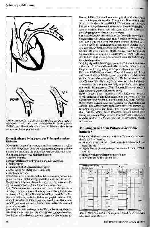 Vorschauseite 3: Der Swan-Ganz-Katheter - Pflegerische Aufgaben beim Legen des Katheters und Überwachen der Patienten