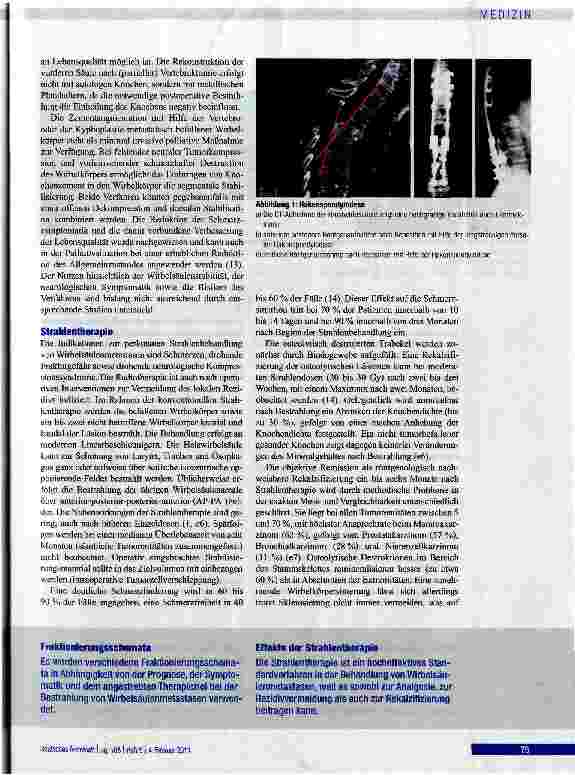 Vorschauseite 5: Behandlung von Wirbelsäulenmetastasen