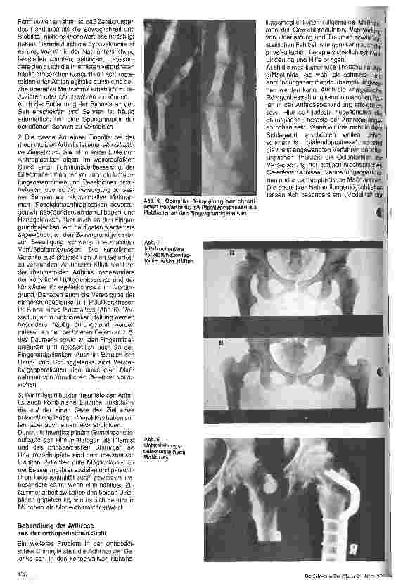 Vorschauseite 4: Aktuelle Probleme in der Orthopädie